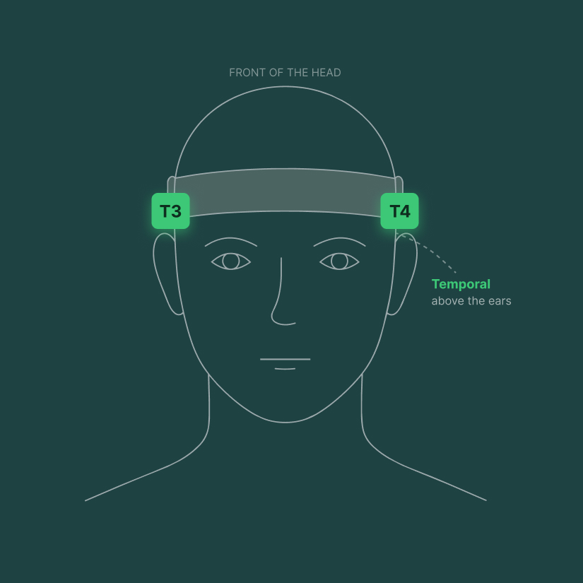 Head showing the T3 and T4 temporal EEG sensor positions above the ears