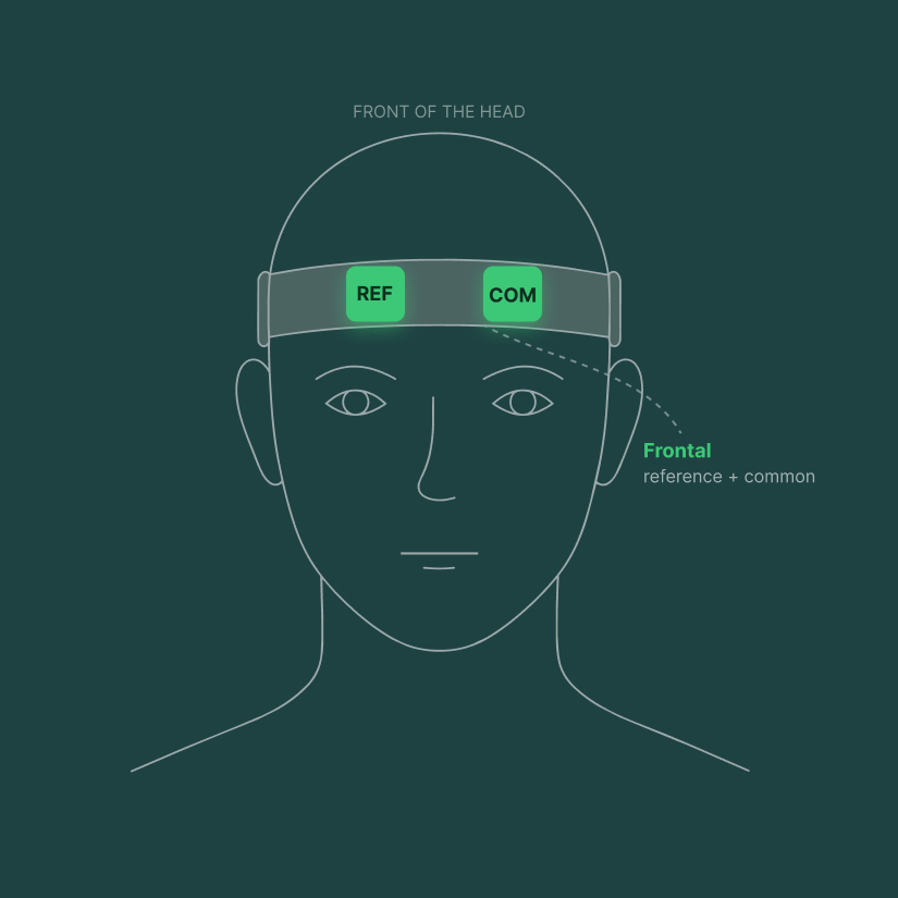 Front view of the head showing the frontal reference and common electrodes